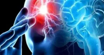 أسباب زيادة خطر السكتة الدماغية شتاءً وطرق الوقاية