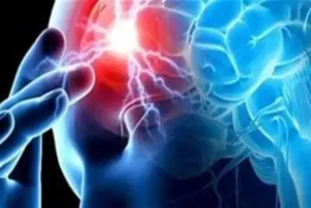 صورة توضيحية للمقال