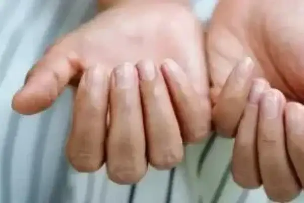 صورة توضيحية للمقال