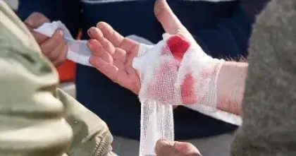 مسحوق رذاذي جديد لإيقاف النزيف الحاد