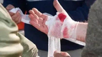 مسحوق رذاذي جديد لإيقاف النزيف الحاد