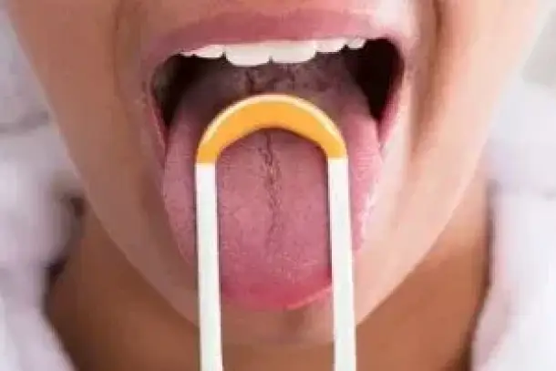 صورة توضيحية للمقال