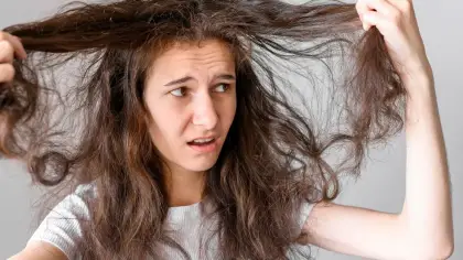 تفسير رؤية القمل في الشعر ودلالاته للمرأة الحامل
