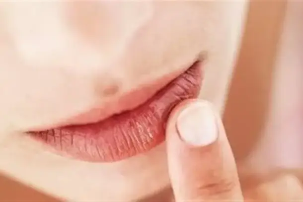 صورة توضيحية للمقال