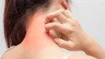 علامات سرطان الجلد المبكرة وأعراضه التحذيرية