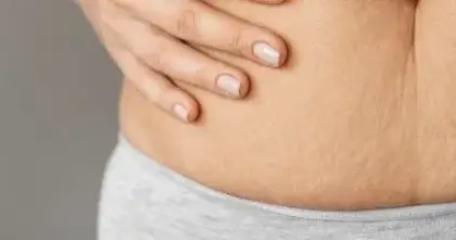 وصفات طبيعية لتقليل السيلوليت وتحسين مظهر البشرة