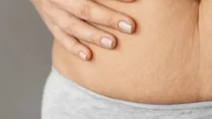 وصفات طبيعية لتقليل السيلوليت وتحسين مظهر البشرة
