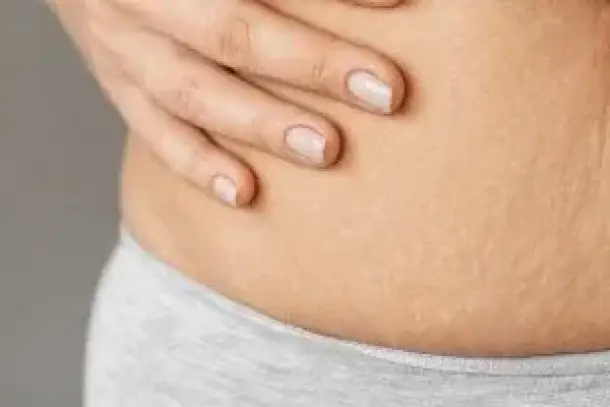 صورة توضيحية للمقال