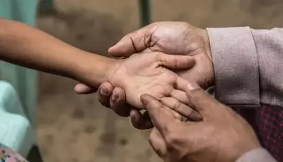 الجذام: مرض مزمن، سبل العلاج، ومكافحة الوصمة
