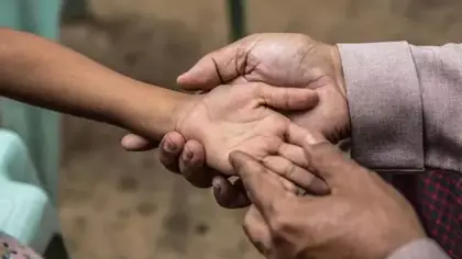 الجذام: مرض مزمن، سبل العلاج، ومكافحة الوصمة