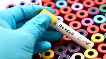 دلالات تحليل فيروس الكبد B الإيجابي وأنواعه