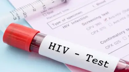 تحليل فيروس نقص المناعة البشرية (HIV) وأنواعه