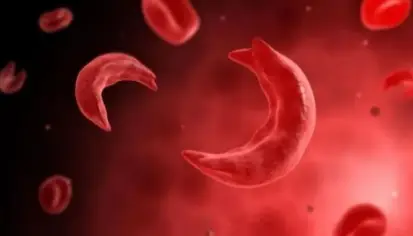 فقر الدم المنجلي: الأعراض والأسباب والوقاية والعلاج