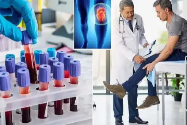 صورة توضيحية للمقال