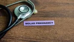 الحمل العنقودي: أنواعه، تشخيصه، وعلاجه