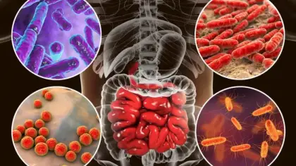 بكتيريا الأمعاء تعزز فعالية العلاج المناعي للسرطان