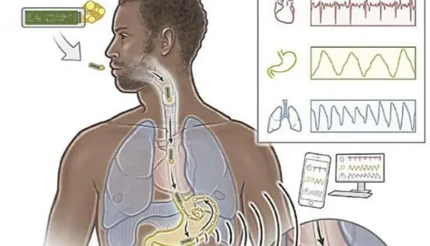 صورة توضيحية للمقال
