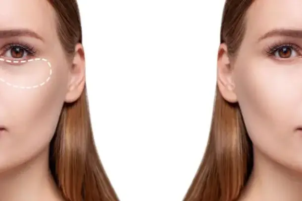صورة توضيحية للمقال