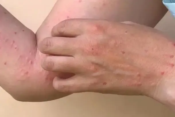 صورة توضيحية للمقال