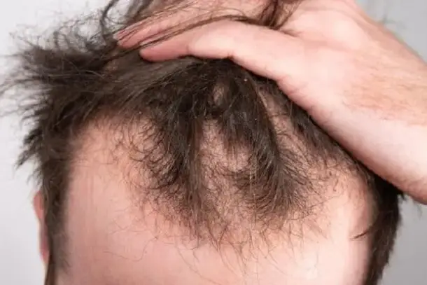 صورة توضيحية للمقال
