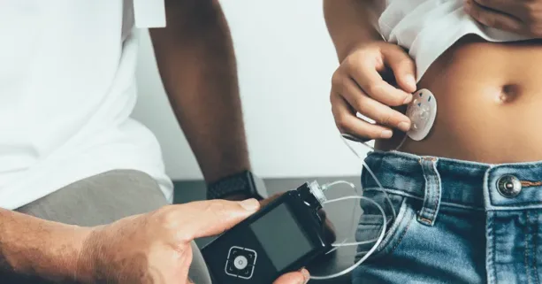 صيام مرضى السكري من النوع الأول باستخدام مضخة الأنسولين