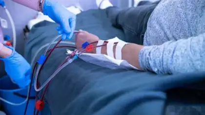 صيام مرضى غسيل الكلى في رمضان وتأثيره على القلب