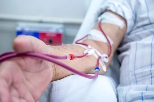 صيام مرضى غسيل الكلى في رمضان وتأثيره على القلب