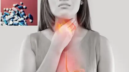 مخاطر الأوميبرازول على الجهاز الهضمي وعلاج الارتجاع