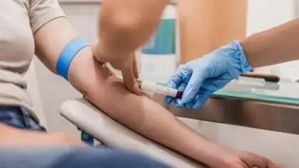 فحص دم جديد للكشف المبكر عن سرطان المبيض