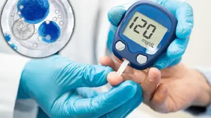 زرع خلايا بنكرياسية معدلة لإنتاج الأنسولين
