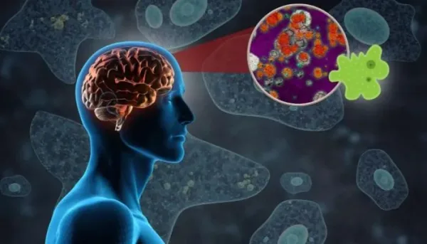 الأميبا آكلة الدماغ: أسبابها وأعراضها والوقاية منها