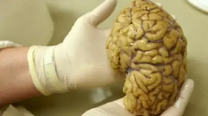 دور خلايا الدماغ في معالجة اللايقين