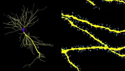 برنامج ذكاء اصطناعي لتحليل خلايا الدماغ