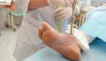 علاج تجريبي لمضاعفات السكري والالتهاب المزمن