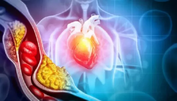عقار إنيليسايتيد الجديد لخفض الكوليسترول الضار