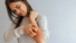 الحكة الجلدية: علامة على أمراض داخلية خطيرة