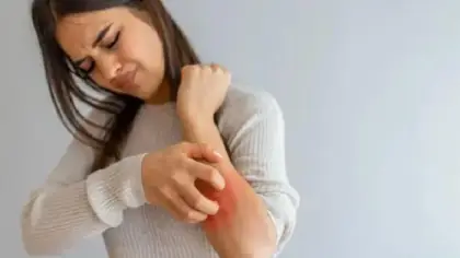 الحكة الجلدية: علامة على أمراض داخلية خطيرة