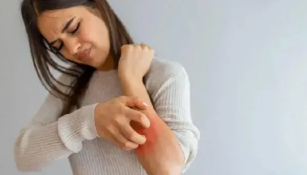 الحكة الجلدية: علامة على أمراض داخلية خطيرة