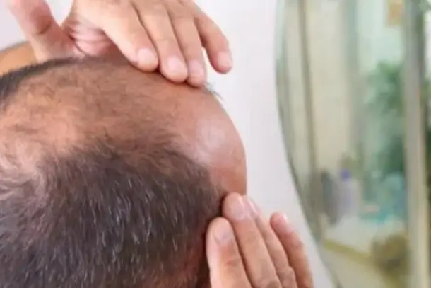 صورة توضيحية للمقال