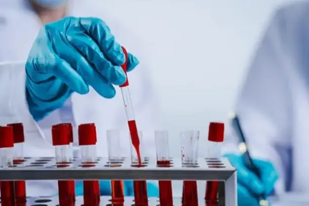 أهمية اختبار الدم الجديد في التشخيص المبكر لمرض العصبون الحركي وتأثيره على رعاية المرضى.