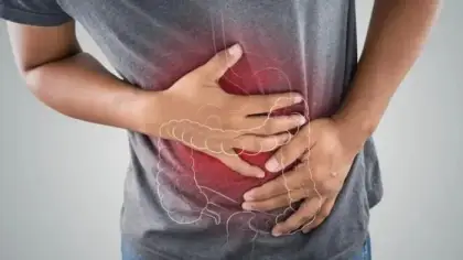 بكتيريا الأمعاء ودورها في سرطان القولون المبكر