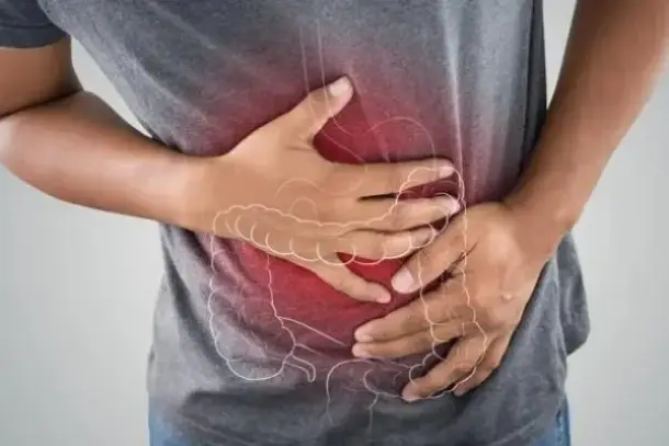 اكتشاف العلاقة بين بكتيريا الأمعاء وسم الكوليبكتين وظهور سرطان القولون في سن مبكرة.
