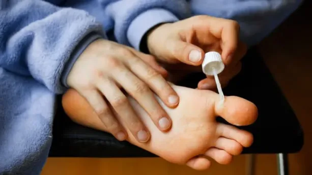 ثآليل اليدين والقدمين: الأسباب والعلاج