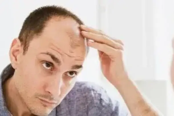 صورة توضيحية للمقال