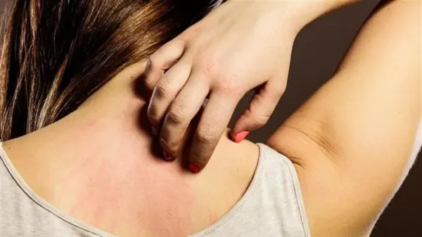 الجزيئات البلاستيكية الدقيقة تزيد خطر الحساسية