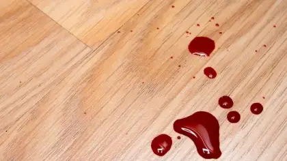 تفسير رؤية الدم في المنام ودلالاته المتعددة