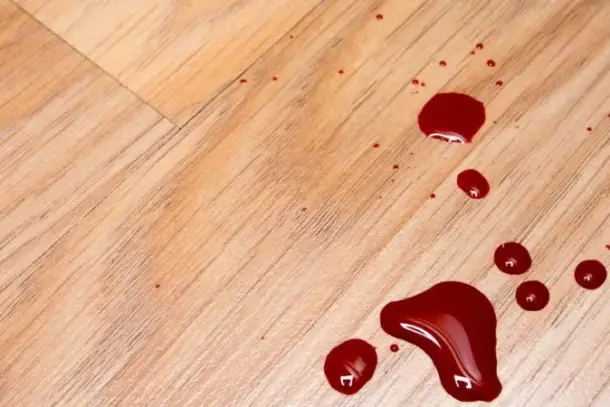 تنوع دلالات رؤية الدم في المنام بين القلق والأمل بناءً على تفاصيل الحلم وحالة الرائي.