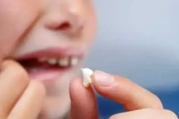 رؤية ضرس العقل في المنام