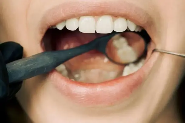 صورة توضيحية للمقال