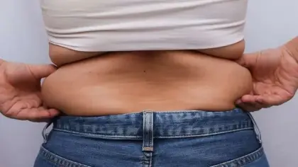 معنى رؤية عمليات التجميل وشفط الدهون في الأحلام